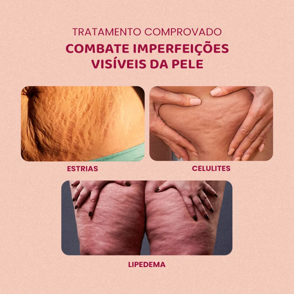 [PAGUE 1 LEVE 4] - Popozuda Creme Rosa Corporal Anticelulite E Estrias 200g